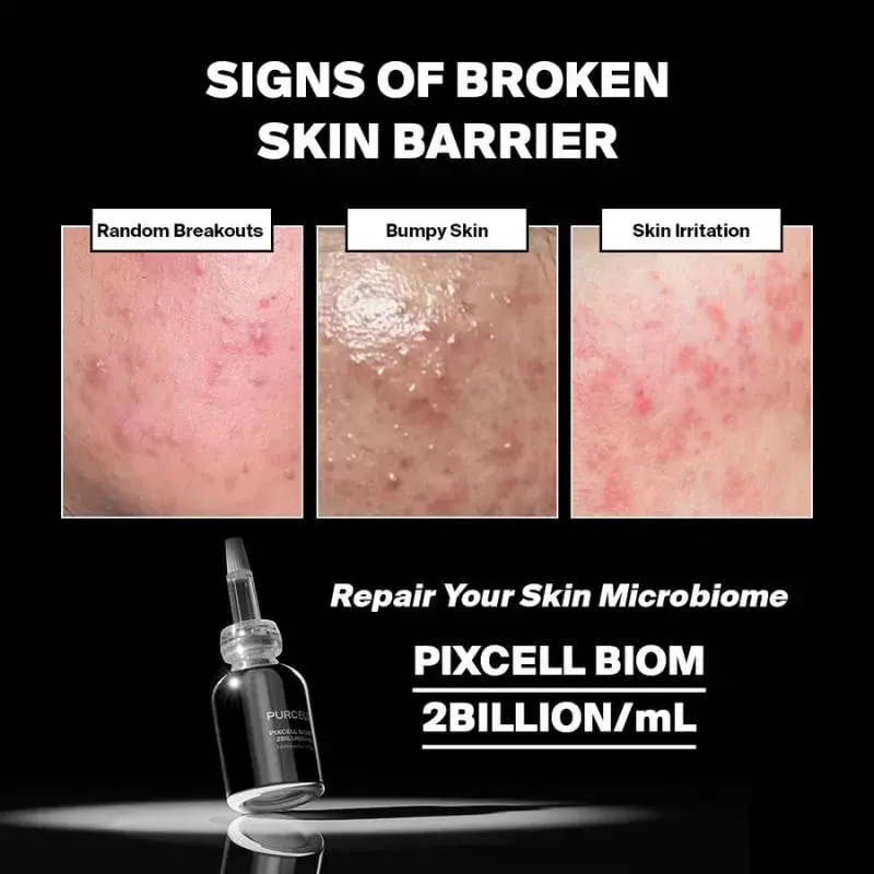 Through-Hull Transducer PURCELL - Pixcell Biom™ 2Billion/mL